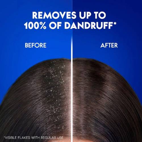Selsun Blue Dandruff Shampoo Medicated with Menthol