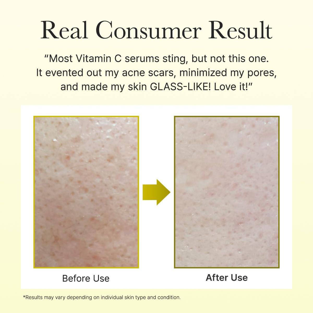 ARENCIA Vitamin C Booster Shot  10ml product image